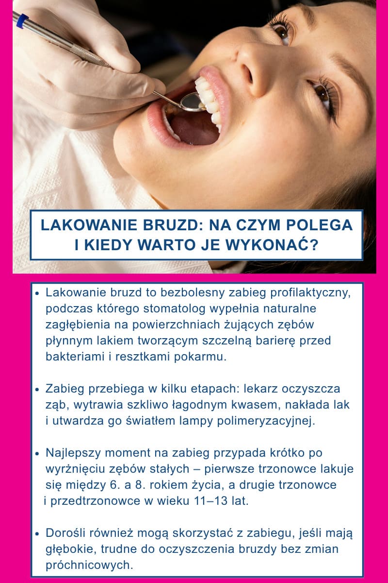 Lakowanie bruzd: na czym polega i kiedy warto je wykonać?